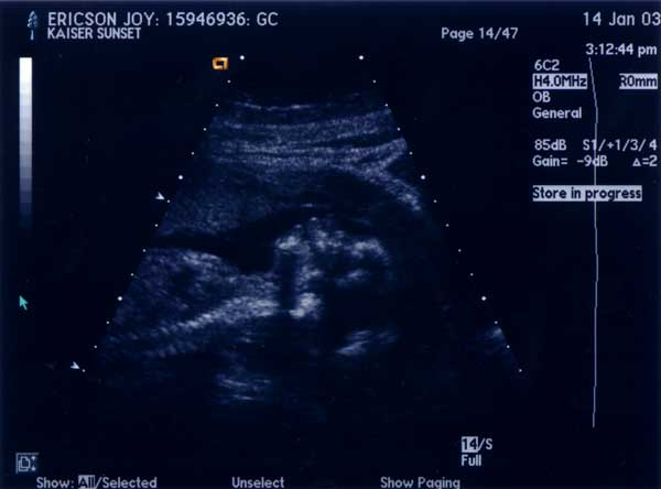 [Image of our baby in profile]